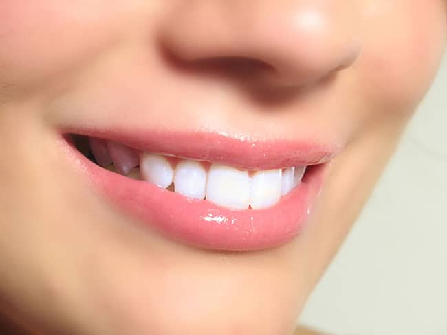 Nổi đau đằng sau nụ cười "toả nắng" từ việc tẩy trắng răng 7 cuoi