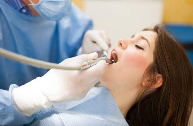 Nổi đau đằng sau nụ cười "toả nắng" từ việc tẩy trắng răng 6 nha si 2