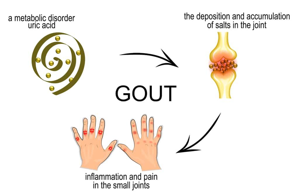 Viên uống hỗ trợ điều trị bệnh Gút Gout Clear 60 viên