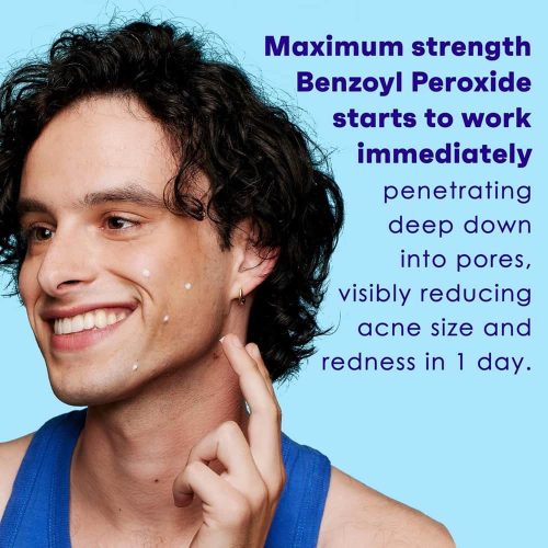 gel tri mun sieu toc clean clear persa gel maximum strength 28g 311224 ke