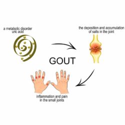 Phòng ngừa và hỗ trợ bệnh Gout Blackmores Celery 3000mg 50 viên 11 Viên uống phòng ngừa và điều trị bệnh Gout Blackmores Celery 3000mg 50 viên