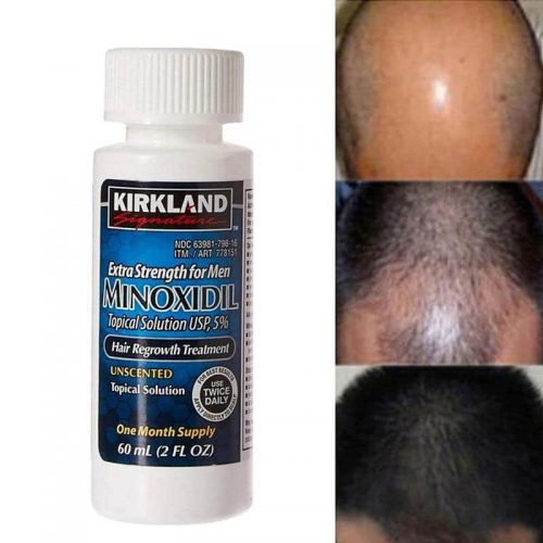 Dung dịch (Gel) mọc tóc cho nam Kirkland Minoxidil 5% Hair Regrowth  Treatment Hộp 6 ống x60ml – Wowmart VN | 100% hàng ngoại nhập