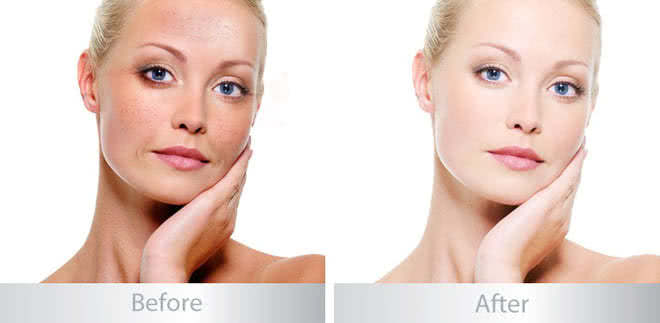 Viên uống dưỡng trắng da hoàn hảo Beauty Skin 60 viên