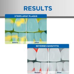 crest pro health hd daily two step toothpaste 3