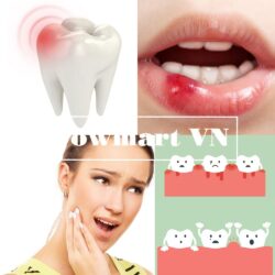 Gel bôi giảm viêm đau răng lợi (nướu răng) Orajel Double Medicated Liquid 13.3ml 6 viem dau nuou rang