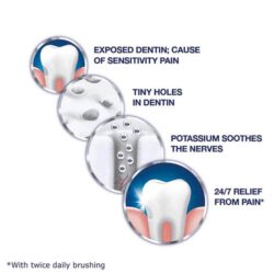 loc 4 kem danh rang cho rang nhay cam sensodyne extra whitening 184g x4 knd