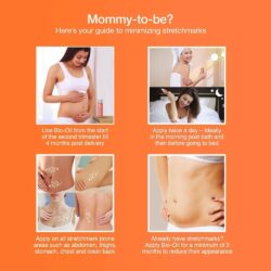 Tinh dầu chống rạn da dành cho bà bầu Bio Oil 125ml Mỹ 8 tinh dau ho tro phuc hoi da bio oil specialist skincare 125ml kna