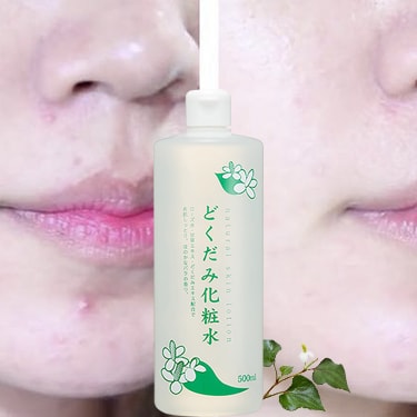 Nước hoa hồng Diếp Cá Dokudami Natural Skin Lotion 500ml – Wowmart VN |  100% hàng ngoại nhập