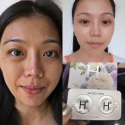 Serum cấp nước Micro Pura H6 20 viên 40ml 7 h6