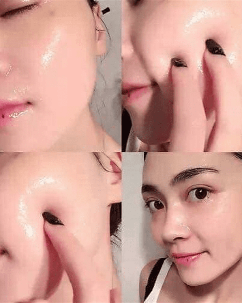 Tái sinh da bằng DNA cá hồi Super Skin Salmon DNA Ampoule 10 ống