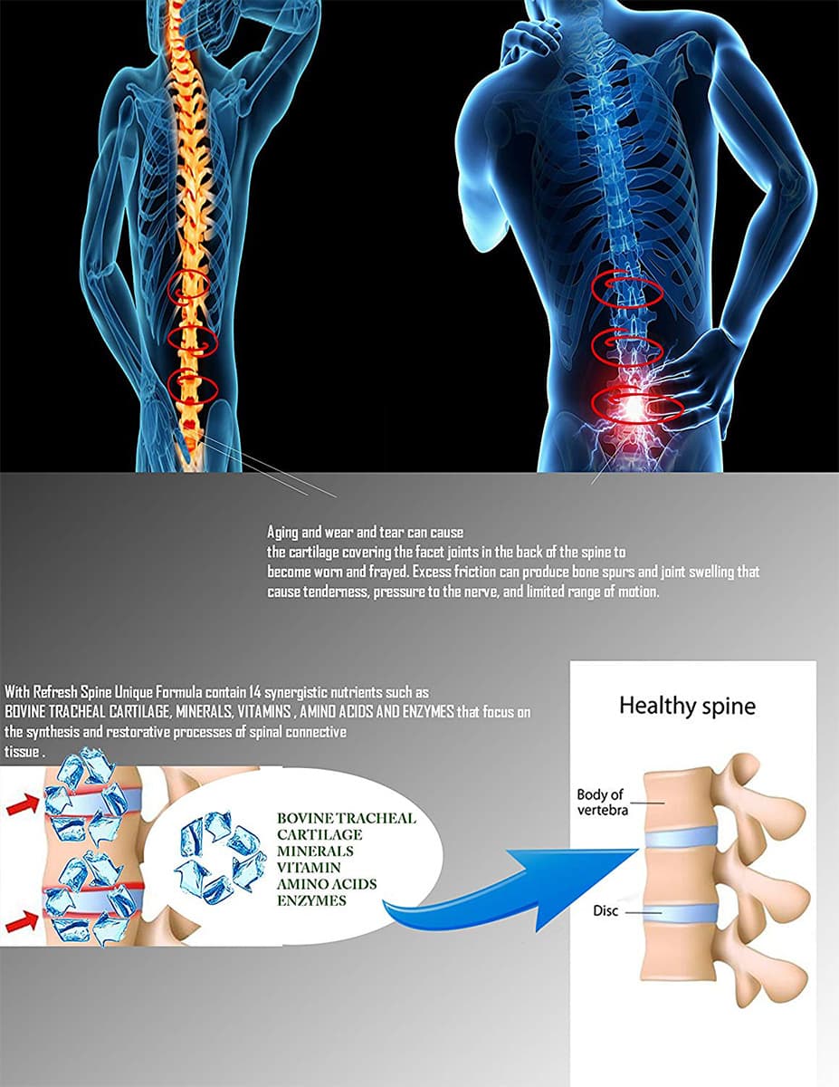 Viên uống hỗ trợ điều trị thoái hóa cột sống, thoát vị đĩa đệm Refresh Spine 180 viên