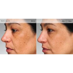 Serum trắng da, giảm vết nám Murad Age Spot and Pigment Lightening Serum 10ml 4 Serum chống lão hóa trị nám da Murad Age Spot and Pigment Lightening Serum 30ml