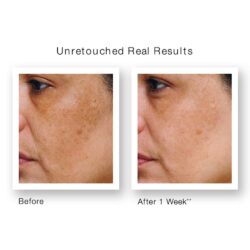 Serum trắng da, giảm vết nám Murad Age Spot and Pigment Lightening Serum 10ml 5 Serum chống lão hóa trị nám da Murad Age Spot and Pigment Lightening Serum 30ml