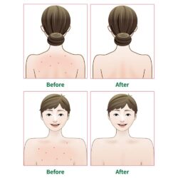 Toner xịt diệt mụn toàn thân Murad Clarifying Body Spray 130ml 7 Toner xịt trị mụn toàn thân Murad Clarifying Body Spray 130ml