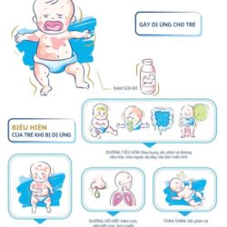Sữa Enfamil Nutramigen từ 0-12 tháng tuổi dị ứng đạm sữa bò 561g 15 sua enfamil nutramigen tu 0 12thang tuoi bi di ung dam sua bo trong 48gio 561g knwb