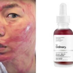 Dung dịch The Ordinary tẩy tế bào chết AHA 30% + BHA 2% Peeling Solution 30ml 17 dung dich the ordinary tay te bao chet aha 30 bha 2 peeling solution 30ml 6