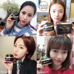 kem duong tri nam dongsung rannce cream 70g a