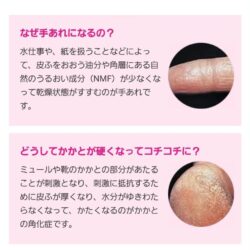 Kem giảm nứt nẻ chân tay Urea Shiseido 100g 7 kem tri nut ne chan tay urea shiseido 100g 1