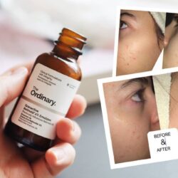 Serum chống lão hóa The Ordinary Granactive Retinoid 2% Emulsion 30ml 12 serum chong lao hoa the ordinary granactive retinoid 2 emulsion 30ml 5