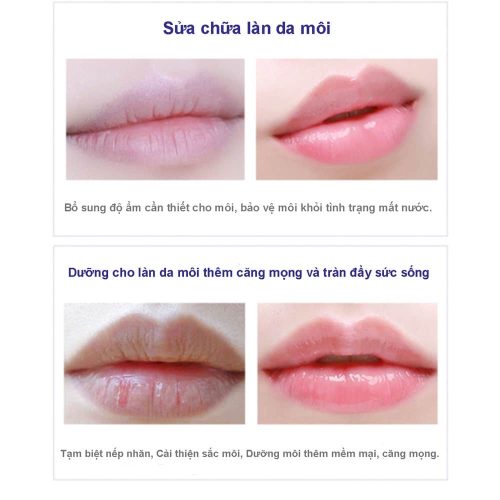 son duong khong mau blistex lip medex 7g 110624 kh