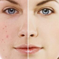 Sữa rửa mặt Murad Environmental Shield Essential C Cleanser 200ml 9 sua rua mat murad environmental shield essential c 200ml 3