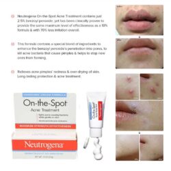 kem tri mun neutrogena on the spot acne treatment clinically proven power 21g 4