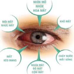 vien uong bo mat cai thien thi giac q p kowa nhat ban 180 vien0A1 6