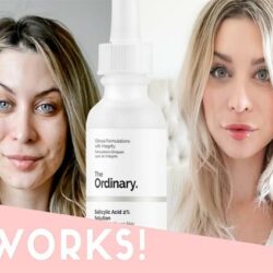 Tẩy tế báo chết The Ordinary Salicylic Acid 2% Solution 30ml 10 Tay te bao chet The Ordinary Salicylic Acid 2 Solution 30ml 3