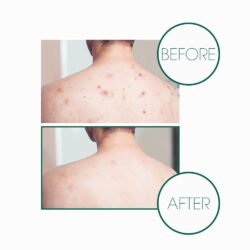 Xà phòng tẩy da chết và làm sạch tạp chất Miracle Cleansing Bar 10 Xa phong tay da chet va lam sach tap chat Miracle Cleansing Bar3