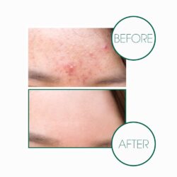 Xà phòng tẩy da chết và làm sạch tạp chất Miracle Cleansing Bar 11 Xa phong tay da chet va lam sach tap chat Miracle Cleansing Bar4