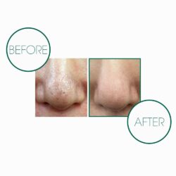 Xà phòng tẩy da chết và làm sạch tạp chất Miracle Cleansing Bar 12 Xa phong tay da chet va lam sach tap chat Miracle Cleansing Bar5