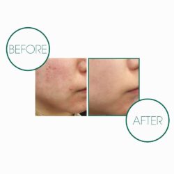 Xà phòng tẩy da chết và làm sạch tạp chất Miracle Cleansing Bar 13 Xa phong tay da chet va lam sach tap chat Miracle Cleansing Bar7