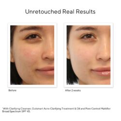 Kem dưỡng kiểm soát dầu Murad Oil Control Mattifier Broad Spectrum SPF 45 50ml 8 kem duong kiem soat dau murad oil control mattifier broad spectrum spf 45 50ml ka