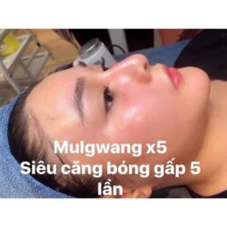 huyet thanh dac tri mun mulgwang diamond m13 10ml kb