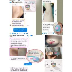 kem tri tham nhu hoa ben nach genie virgin peach 3 in 1 5ml kc