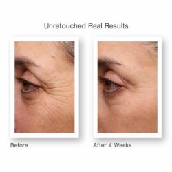 Serum giảm nhăn, mờ thâm mắt Murad Retinol Youth Renewal Eye Serum 5ml 5 serum giam nhan mo tham mat murad retinol youth renewal eye serum 5ml kb