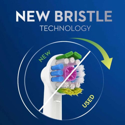 Bàn chải đánh răng sạc điện Oral-B Vitality Plus Pro White 18 ban chai danh rang sac dien oral b vitality plus pro white 180625 ke