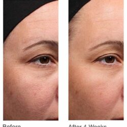 kem duong xoa nhan ban dem murad retinol youth renewal night cream 7 5ml kb