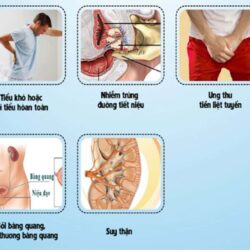 vien uong ho tro dieu tri tuyen tien liet blackmores prostate health formula 60 vien ke