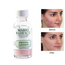 dac tri mun tham mun mario badescu drying lotion 29ml ka