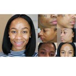 dac tri mun tham mun mario badescu drying lotion 29ml kb