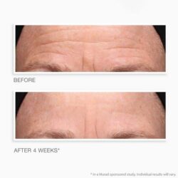 Kem dưỡng xóa nhăn ban đêm Murad Retinol Youth Renewal Night Cream 15ml 7 kem duong xoa nhan ban dem murad retinol youth renewal night cream 15ml kb