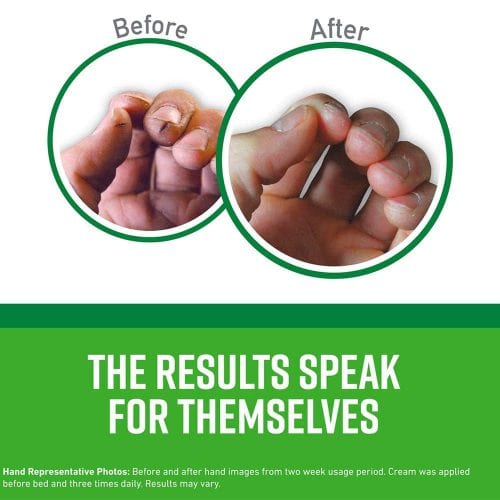 Set dưỡng da chân, tay, môi O’Keeffe’s Guaranteed Relief 17 set duong da chan tay moi okeeffes guaranteed relief kf