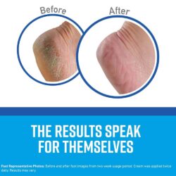 Set dưỡng da chân, tay, môi O’Keeffe’s Guaranteed Relief 12 set duong da chan tay moi okeeffes guaranteed relief kg