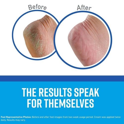 Set dưỡng da chân, tay, môi O’Keeffe’s Guaranteed Relief 18 set duong da chan tay moi okeeffes guaranteed relief kg