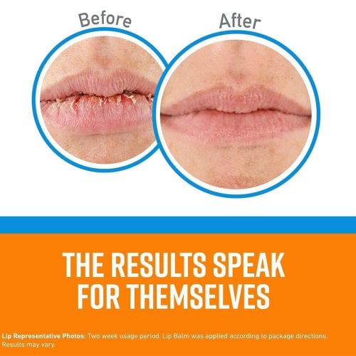 Set dưỡng da chân, tay, môi O’Keeffe’s Guaranteed Relief 19 set duong da chan tay moi okeeffes guaranteed relief kh