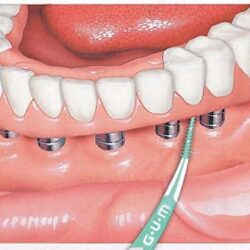 Tăm xỉa răng nha khoa Gum Soft Picks Advanced 270 cái 7 tam xia rang nha khoa gum soft picks advanced 270 cai kd