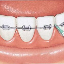 Tăm xỉa răng nha khoa Gum Soft Picks Advanced 270 cái 8 tam xia rang nha khoa gum soft picks advanced 270 cai ke