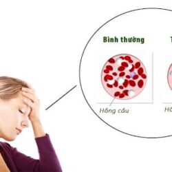 iron thieu sat thieu mau women people