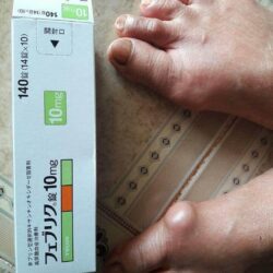 Viên uống hỗ trợ bệnh gout Feburic Tablet 10mg 140 viên 7 vien uong ho tro benh gout feburic tablet 10mg 140 vien kb
